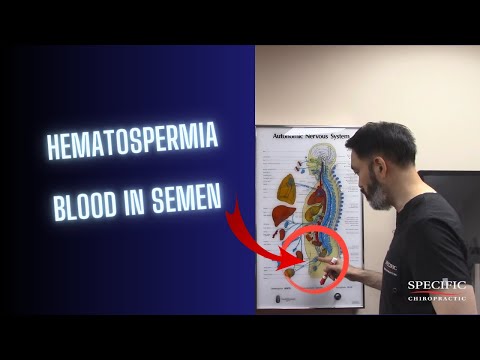 Hematospermia, BLOOD in Semen HELPED at Specific Chiropractic NYC