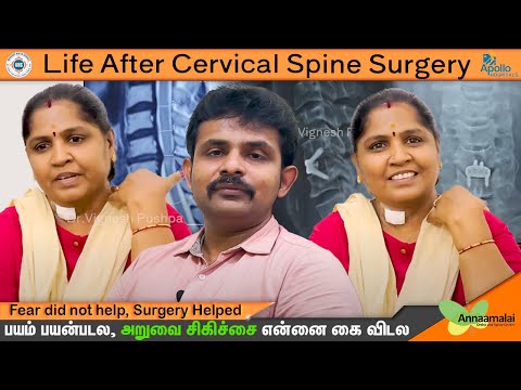 Life After Cervical Spine Surgery (ACDF) - patient testimonial