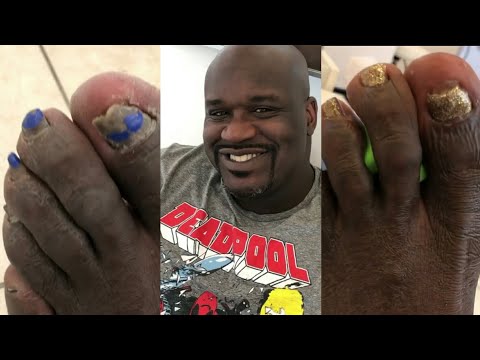 SHAQUILLE O'NEAL FEET??