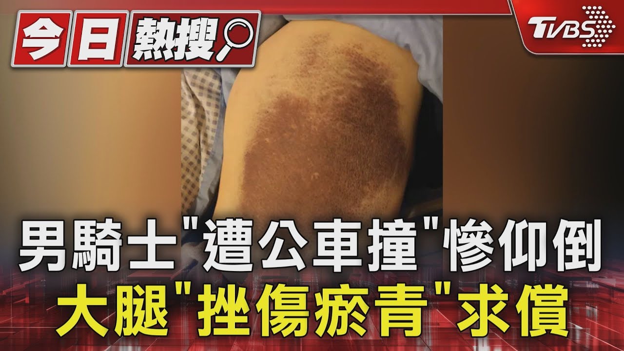 男騎士「遭公車撞」慘仰倒 大腿「挫傷瘀青」求償