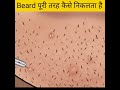 Beard पूरी तरह निकालने का तरीका Shorts Ytshorts Fact