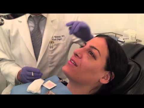download lagu mp3 mp4 Best Rhinoplasty New York, download lagu Best Rhinoplasty New York gratis, unduh video klip Best Rhinoplasty New York