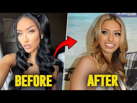 Selling Sunset Bre Tiesi’s Drastic Transformation After Surgery Has Fans Concerned