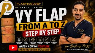 VY Flap