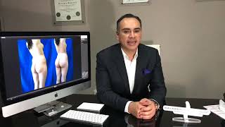 Tema de costos en las Cirugías.