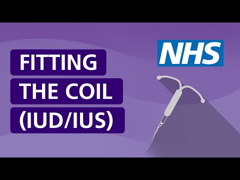 Fitting the coil (IUD/IUS) | NHS