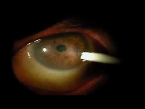 Reduceri pentru examinarea ochilor