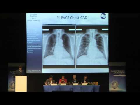 Ákos Horváth: A success story in fund raising