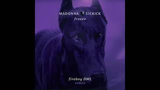 Madonna Vs Sickick - Frozen (Fireboy DML Remix)
