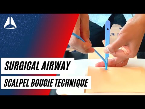 Scalpel bougie technique in CICO emergencies | Airway Management