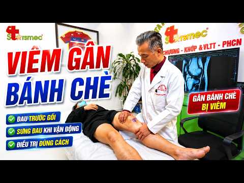 Đau Gối Do Viêm Gân Bánh Chè Kéo Dài? 80% Người Đang Điều Trị Sai!