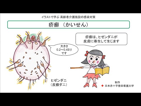 イラストで学ぶ介護施設の感染対策「疥癬」編