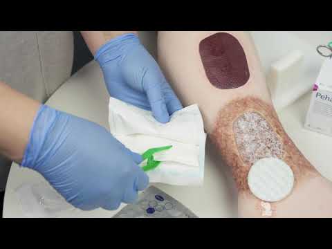 medicament super articular cauzele artrozei în articulația genunchiului