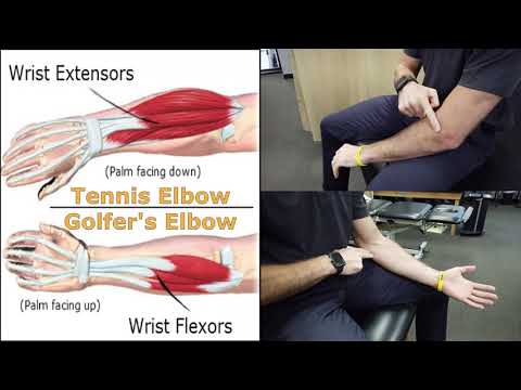 Tennis Elbow or Golfer Elbow