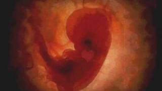 Efecto Mariposa - Flotando Voy