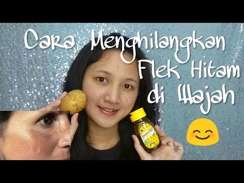 Sverhszhigatel ulasan lemak Slimming Capsule Intensif pelangsing olahraga Hidup Harga