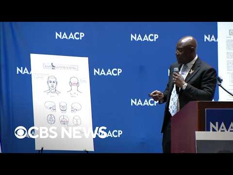 Nolan Wells' preliminary independent autopsy results read by attorney Ben Crump