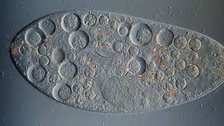 Paramecium Characteristic &amp; Structure | Under The Microscope