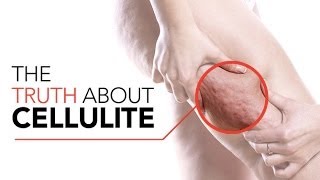 How to GET RID OF CELLULITE (Best Exercises and Tips to Reduce Cellulite!!)