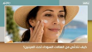 كيف نتخلّص من الهالات السوداء تحت العينين؟