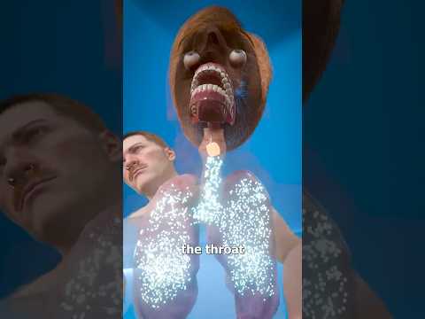 Wie das Heimlich-Manöver funktioniert 😨 Reaktion des Chirurgen