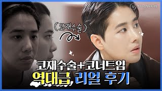 코재수술+코너트임 2주차 리얼후기