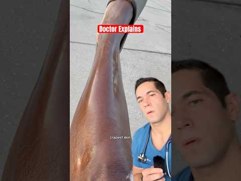 Why this smooth skin is a BAD sign