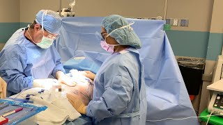 The Cost of Tummy Tuck Surgery