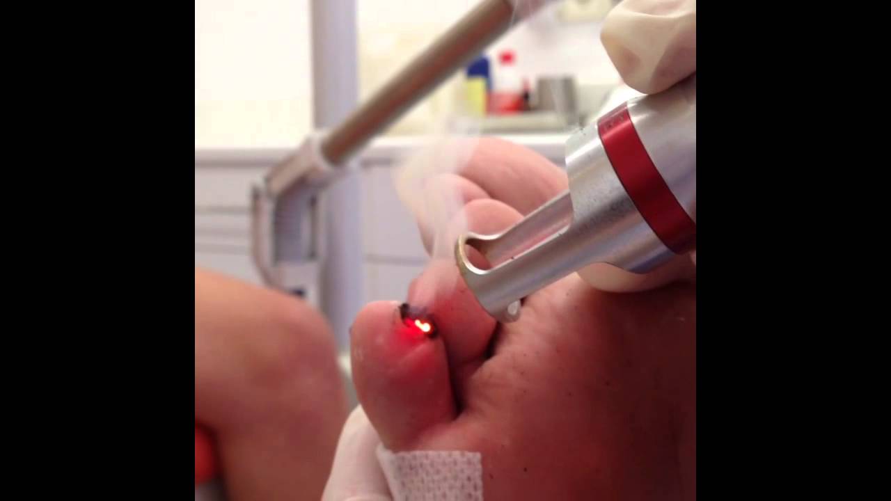 Xabier Mediavilla Gonzalez-16