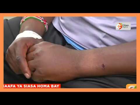 Watu wawili wafariki na wengine 53 kujeruhiwa wakati wa vurugu zilizokumba kaunti ya Homa Bay