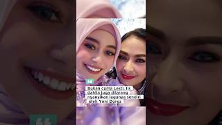 Download lagu Bukan cuma Lesti, Iis Dahlia juga bingung dilarang nyanyi lagu ciptaan Yoni Dores mp3 Download lagu Bukan cuma Lesti, Iis Dahlia juga bingung dilarang nyanyi lagu ciptaan Yoni Dores mp3