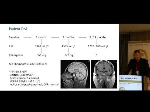 Mastorakos George - Macroprolactinoma resistant on therapy