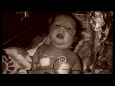 What is Persistent Pulmonary Hypertension of the Newborn?