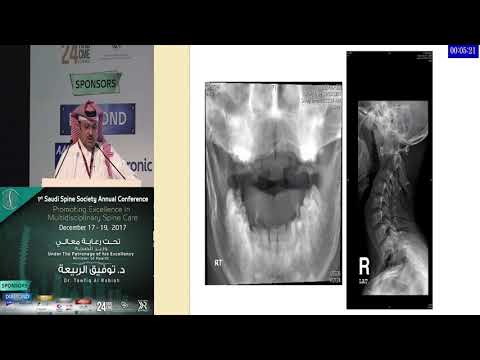 Challenges and Expectations in Revision Cervical Spine Surgery by Dr. Ibrahim Assiri