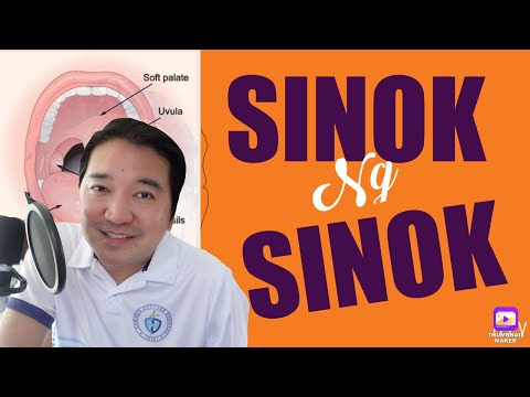 SINOK ng SINOK(Hiccups): WHAT to DO Dr. J?