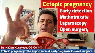 Ectopic pregnancy. Early detection and treatment options. Methotrexate, laparoscopic, open surgery
