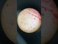 Staining Of Nucleic Acid By Acetocarmine Science Biology Practical