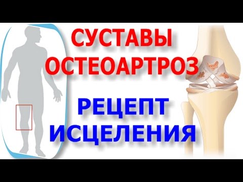 Как не допустить остеохондроза Почему болят суставы и лечение