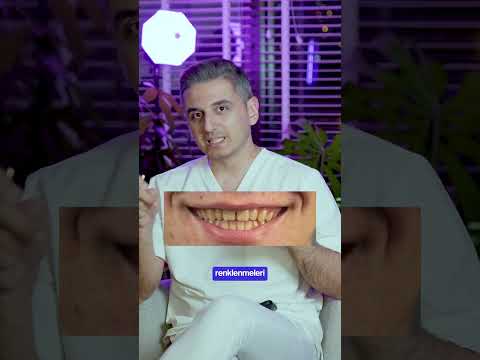 Şeffaf plaklar nasıl temizlenir?