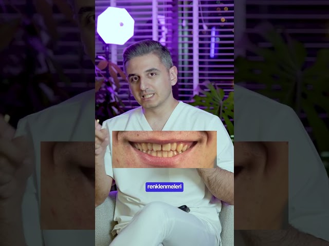 Şeffaf plaklar nasıl temizlenir?