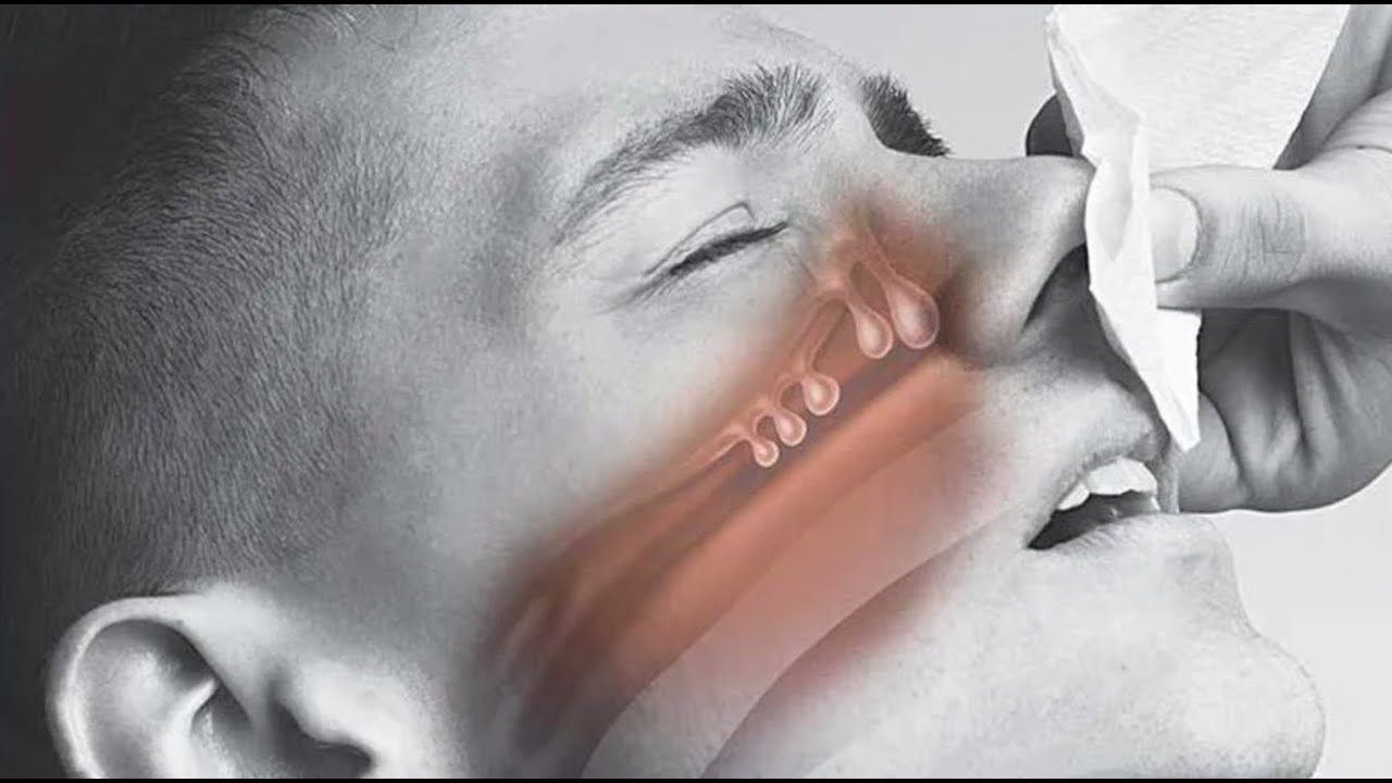 Juan Carlos Ramirez Rivera-49