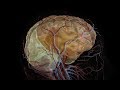 Stroke Vs Aneurysm Different Symptoms Treatments