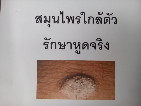 สาเหตุเจ้าหน้าที่ของผู้หญิง BTC ซื้อ คอร์ดเมล็ด Slepakov กระเจี๊ยวขนาดเล็ก