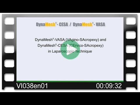 DynaMesh®-CESA /-VASA OR-Video: VAgino-SAcropexy & CErvico-SArocpexy in Laparoscopic Technique