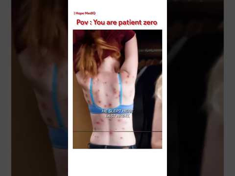 🧬 "PATIENT ZERO" — The Mysterious First Human Infected #anatomy #viralshorts #shorts