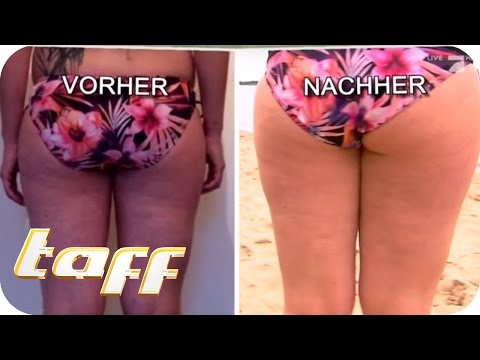 Schmerzen im unteren Rücken auf der linken Seite an der Rückseite der frühen Schwangerschaft Spikes auf dem Gelenk