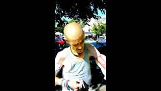 THIS IS WHAT HAPPENS WHEN YOU SHOOT UP HEROIN OR METH!!