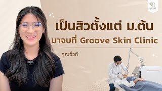 รีวิวรักษาสิว น้องซิ่วกี