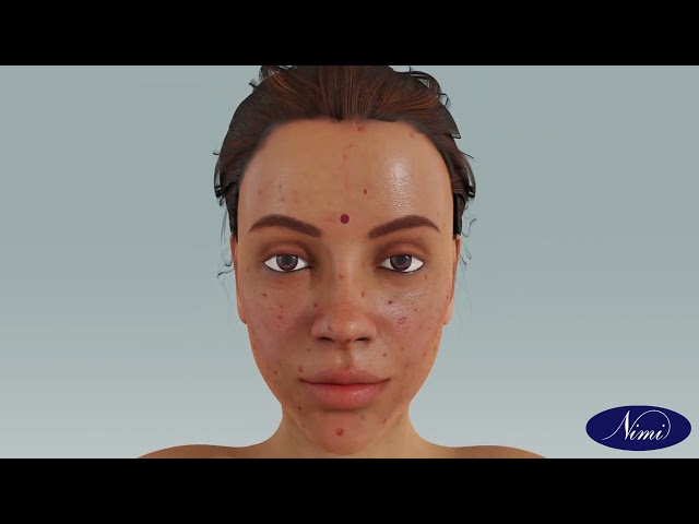 Client Drape & skin Analysis