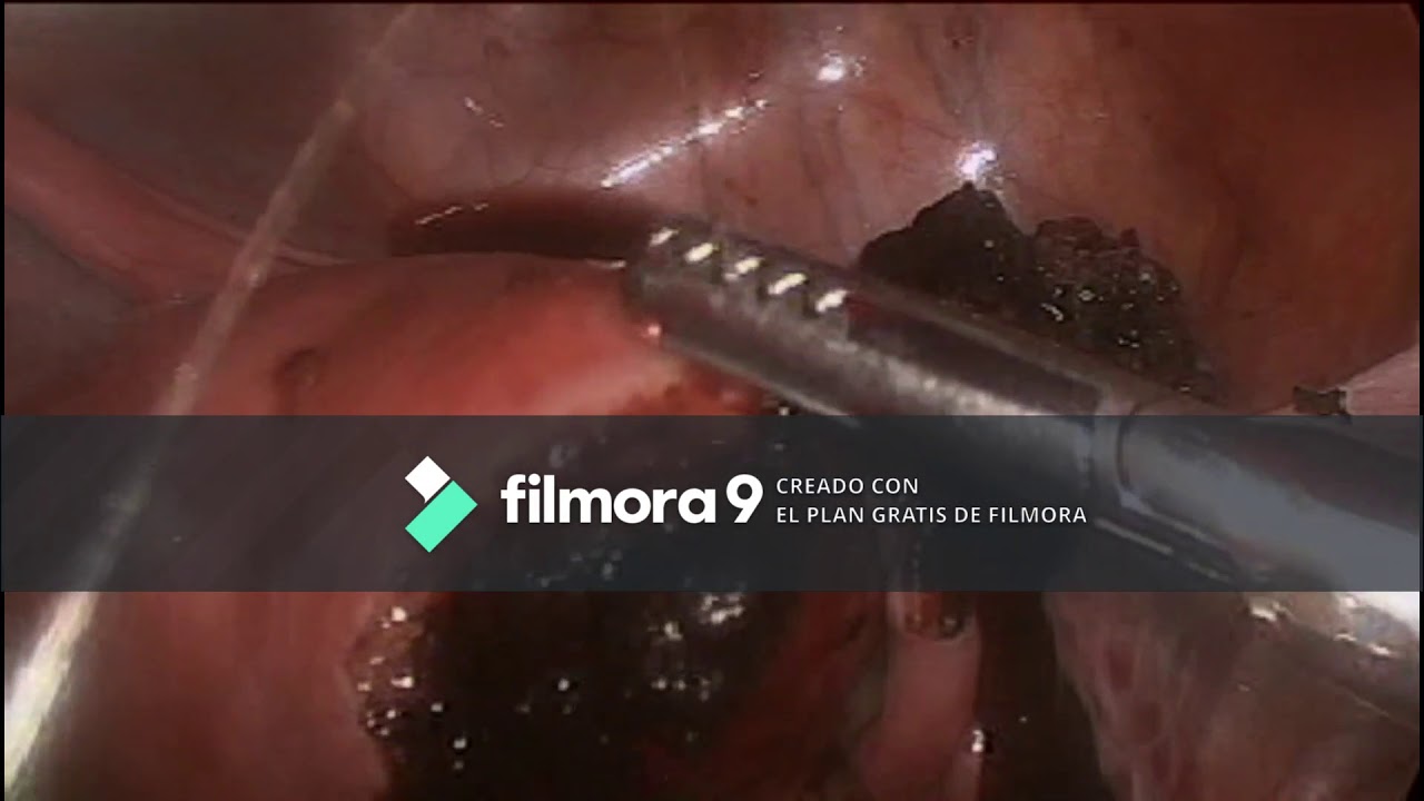 Germán Gabriel Palacios López-44